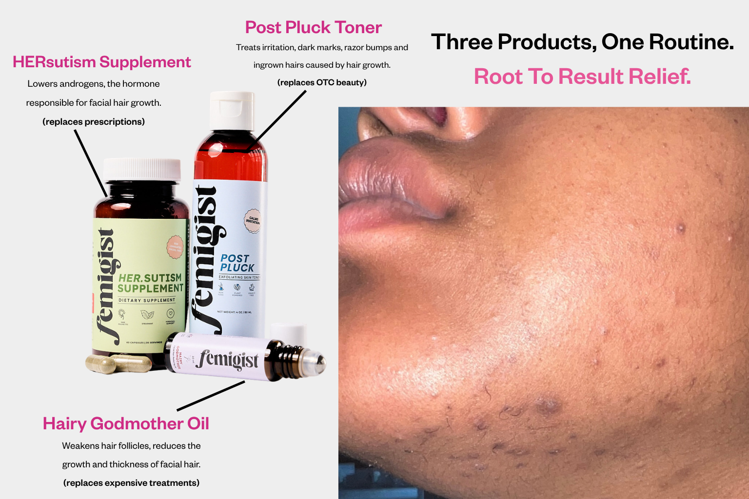The Chin Kit – Complete Solution for Female Facial Hair & Hair Reduction