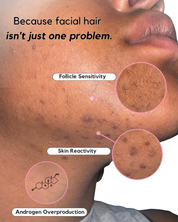 The Chin Kit – Complete Solution for Female Facial Hair & Hair Reduction